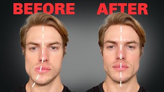 How to Fix Asymmetrical Jaw amp Face FOREVER [upl. by Phila557]