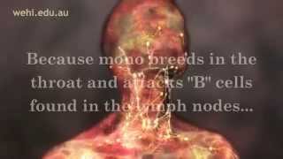 Symptoms of Mono  Mono Symptoms  Infectious Mononucleosis Disease [upl. by Salomone]