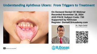 Free Dental CE Webinar Understanding Aphthous Ulcers  From Triggers to Treatment Dr Rajiv Saini [upl. by Aicel928]