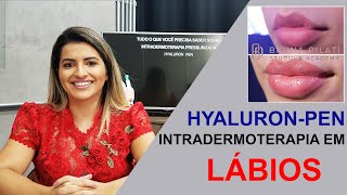 Intradermoterapia Pressurizada em Lábios Hyaluronpen Comfortin [upl. by Colvin]