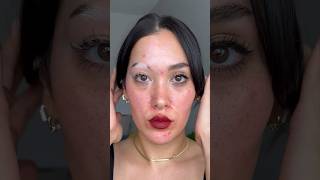 Sharing one of my fav videos as a reminder that no skin is bad 🤍 vitiligo acne poliosis skin [upl. by Attlee956]