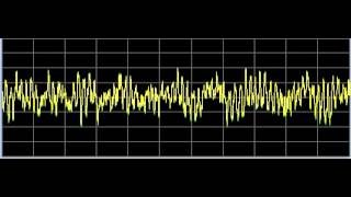 Arthritis 1 and 2  Rife Frequencies [upl. by Eirallam]