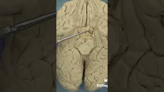 Parahippocampal gyrus uncusanatomyneuroanatomy cerebrumbraincortextemporallobelimbicsystem [upl. by Socram444]