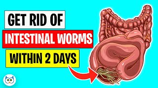 Use These Natural Methods To Get Rid of Intestinal Worms Within Two Days [upl. by Trinia]