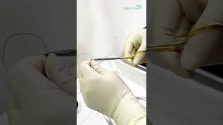 Biopsy for histopathology  Dhaka Dermatology Institute  LaserTreat [upl. by Jesh]