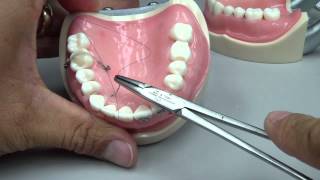 Root Coverage  Sling Suture [upl. by Notsla]