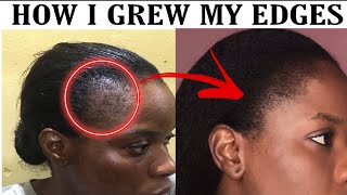 HOW TO GROW EDGES BACK THE NATURAL WAYHOME REMEDYHAIR JOURNEY [upl. by Inafetse541]