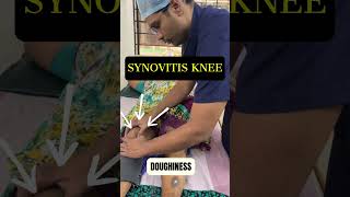 Knee swelling  Synovitis kneepain osteoarthritis shorts [upl. by Adnolrehs]