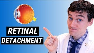 Retinal Detachment Symptoms and Treatment  How Retinal Detachment is Treated [upl. by Rashidi]