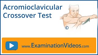 Acromioclavicular Crossover Test [upl. by Carol]