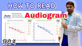 How to read Audiogram  Explained in Hindi  सुनाई की जाँच Audiometry test रिपोर्ट को कैसे पढ़ें [upl. by Anez]