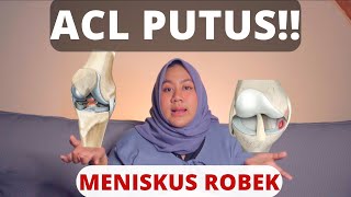 Cerita Putus ACLku Mulai dari MRI sampai Bisa Dioperasi pakai BPJS [upl. by Fayre]