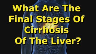 What Are The Final Stages Of Cirrhosis Of The Liver [upl. by Ahsitruc]