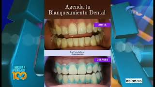 Procedimiento para Blanqueamiento Dental [upl. by Myrilla]