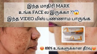 face black mark remove cream best result tamil [upl. by Pernell]