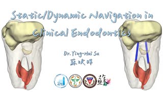 Static and Dynamic Navigation in Clinial Endodontics congress of the APEC annual meeting of AEROC [upl. by Munster]