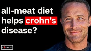 🔴 What Happens To Crohns Disease On a Carnivore Diet [upl. by Carmena228]