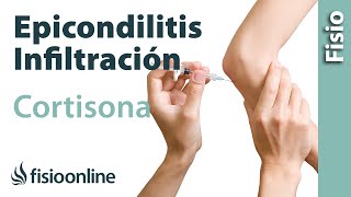 Epicondilitis o codo de tenista y las infiltraciones de cortisona o corticoides [upl. by Lorelie]