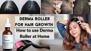 Derma Roller For Hair Growth  How To Use  The Ordinary Multipeptide Serum haircare hairgrowth [upl. by Kurth]