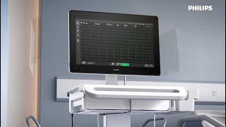 Philips Cardiac Workstation — Tap the power of connected cardiography [upl. by Ayahc]