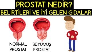 PROSTAT NEDİR BELİRTİLERİ VE TEDAVİ EDEN GIDALAR [upl. by Anayia]