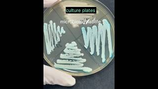 bacterial culture plates  pure culture of bacteria microbiology  microbiologylab shorts short [upl. by Mcgaw]