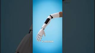 How a robotic Hand Work Robotic Hand Surgery sciencefacts shorts [upl. by Leumek645]