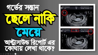 আল্ট্রাসনোগ্রাম রিপোর্ট দেখে কিভাবে বুঝবেন গর্ভের বাচ্চা ছেলে না মেয়ে  pregnancy ultrasound report [upl. by Raleigh]