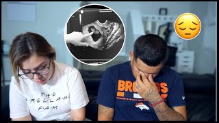 UNEXPECTED PREGNANCY UPDATE│ We got the worst news ever at our first appointment [upl. by Siderf]