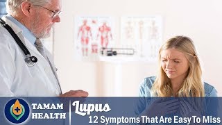 12 Subtle Lupus Symptoms That Are Easy To Miss [upl. by Laflam]