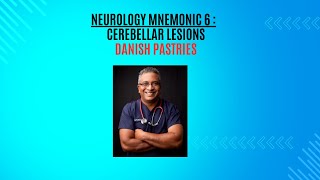 Neurology Mnemonic 6  Cerebellar lesions [upl. by Suiremed]