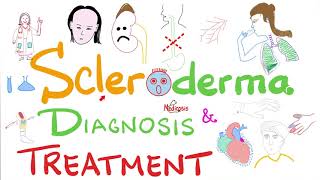 Scleroderma Diagnosis and Management [upl. by Delamare]