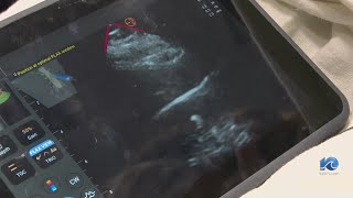 Virginia Beach EMS introduces field ultrasounds for improved patient care [upl. by Bolanger]