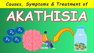 Akathisia by Antipsychotics  Causes Symptoms and Treatments [upl. by Drawde164]