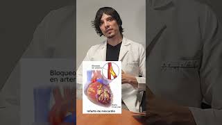 🔹¿Qué es la Pletismografía Arterial de Extremidades Aquí te lo explico 👨‍⚕️ [upl. by Rehptsirhc]