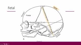 Malpresentation and malposition  obstetrics [upl. by Pegg]