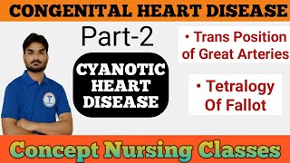 Congenital Heart Disease Part2 Cyanotic Heart Disease Tetralogy Of Fallot [upl. by Kram]