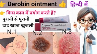 Deribin ointment use in hindi  डेरोबिन ointment use in hindi 30g l use।ointment lviralviralvideo [upl. by Greabe]