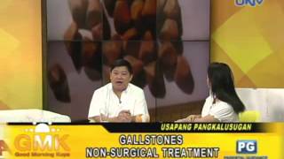 NonSurgical Treatment to Gallstones ENG SUB [upl. by Ojaras335]