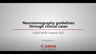 ISUOG 2021 Miguel Branco – Neurosonography guidelines through clinical cases [upl. by Abbot510]