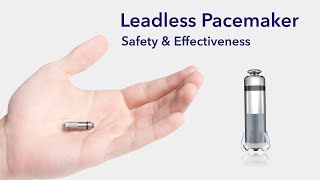 Cardiac Treatment Leadless Pacemakers [upl. by Potter224]