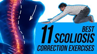 11 Easy Scoliosis Posture Correction Exercises [upl. by Etna]