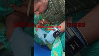 chiropractic chiropractor l4l5s1 slip disc treatment dr satyaketu 9415780685 varanasi up India [upl. by Rudich838]