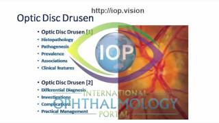 Optic Disc Drusen Part 1 Preview [upl. by Akahs]