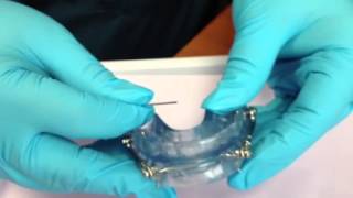 How to Adjust Your Herbst Oral Appliance [upl. by Noyerb]