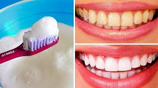 10 formas naturales de blanquear los dientes amarillentos en casa [upl. by Boni]