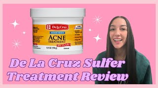 De La Cruz Sulfur Treatment for Acne DOES IT WORK My HONEST review [upl. by Irihs202]