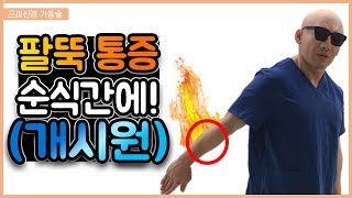 팔뚝 통증 이걸 해보세요 정말 시원합니다 근피신경가동술 eng sub [upl. by Namyl]