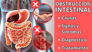 OBSTRUCCIÓN INTESTINAL  Causas signos y síntomas diagnóstico y tratamiento [upl. by Eema888]