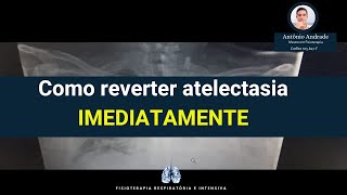 Como Reverter Atelectasia Imediatamente [upl. by Gilly]